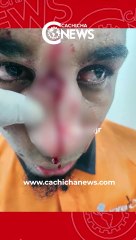 Joven denuncia que fue agredido salvajemente por un policía en Santiago