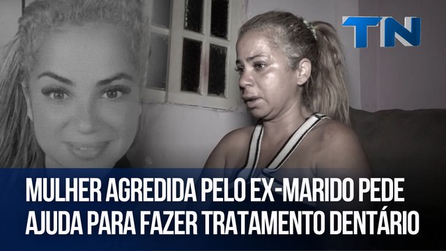 Mulher agredida pelo ex-marido pede ajuda para fazer tratamento dentário