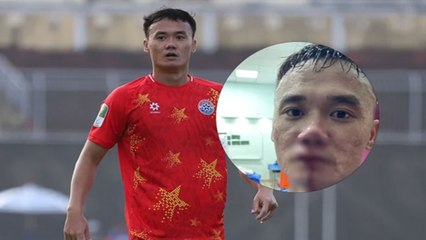 "Dạy dỗ" đàn ông, Tiền đạo Nguyễn Xuân Nam bị đấm chảy máu mũi