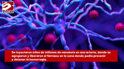Robots diminutos podrían tratar hemorragias cerebrales