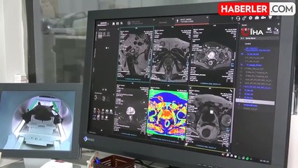 İyi Huylu Prostat Büyümesi Tedavisinde HoLEP Ameliyatı ile Yeni Bir Dönem