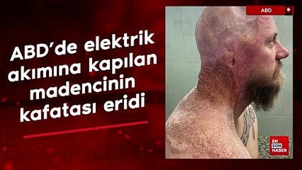ABD'de elektrik akımına kapılan madencinin kafatası eridi