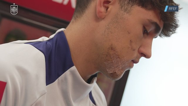 Cubarsí y su ESPECTACULAR MÁSCARA tras RECIBIR 10 PUNTOS en la CABEZA