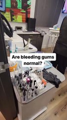 Are Bleeding Gums Normal?