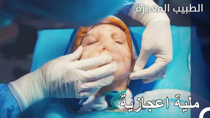 تمت عملية زراعة وجه الفتاة الصغيرة بنجاح - الطبيب المعجزة الحلقة ال 162