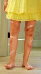 ulik IPL Hair Removal 101