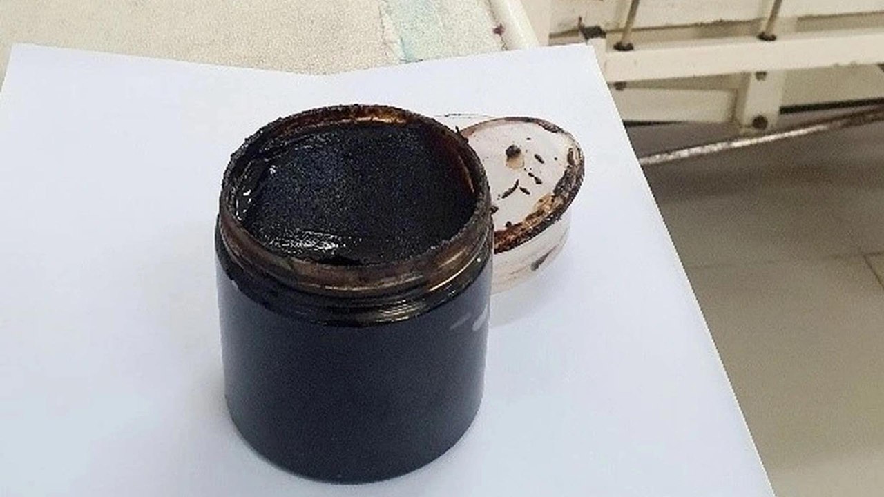 Cây mã tiền: "Sát thủ" ẩn mình trong cao thuốc khiến người đàn ông nhập viện nguy kịch