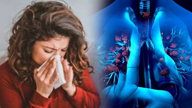 Walking Pneumonia Kya Hai, Pneumonia And Walking Pneumonia Difference, Symptoms...| Boldsky