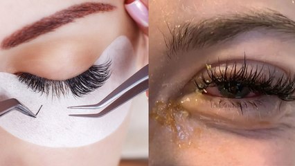 Side Effects Of EyeLashes Extension :Eye Lashes Ke Nuksaan,Eye Irritation, Infection Or Dry Eyes..