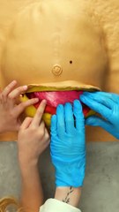 Child operation practice