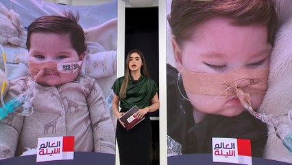 محكمة بريطانية تأمر بإزالة أجهزة التنفس عن الطفل أيدن براكي
