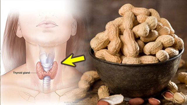 Thyroid Me Mungfali Kha Sakte Hai| Peanut Health Benefits In Hindi | Boldsky