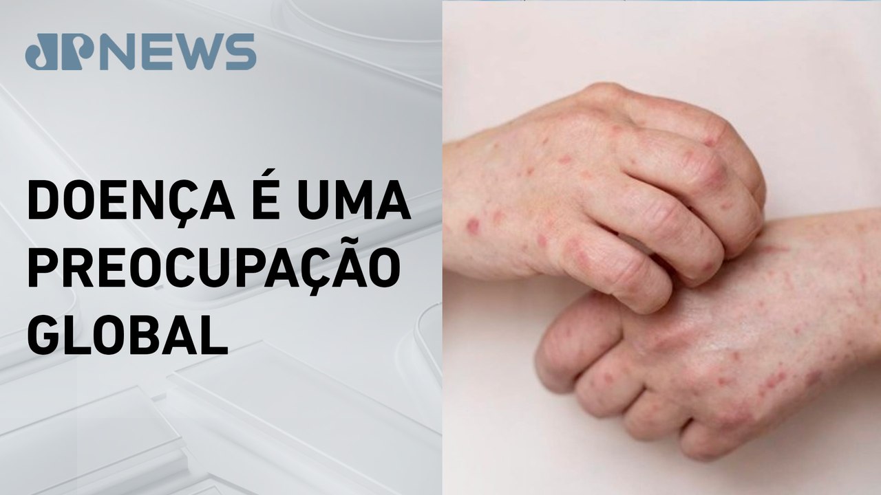 Mais de 1,5 mil casos de Mpox foram registrados no Brasil em 2024