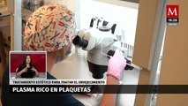 El plasma en medicina estética y sus beneficios