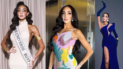 Miss Universe 2024: First Woman Participant Logina Salah With Vitiligo, Life Story | Boldsky