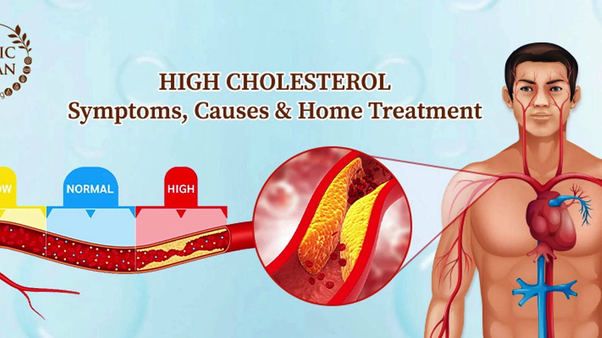 Types of Cholesterol