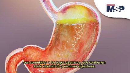 ¿Qué es la indigestión y cómo afecta a tu cuerpo?