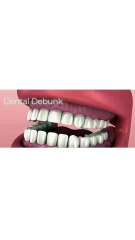 Dental Debunk: The Truth About Pericoronitis 🦷