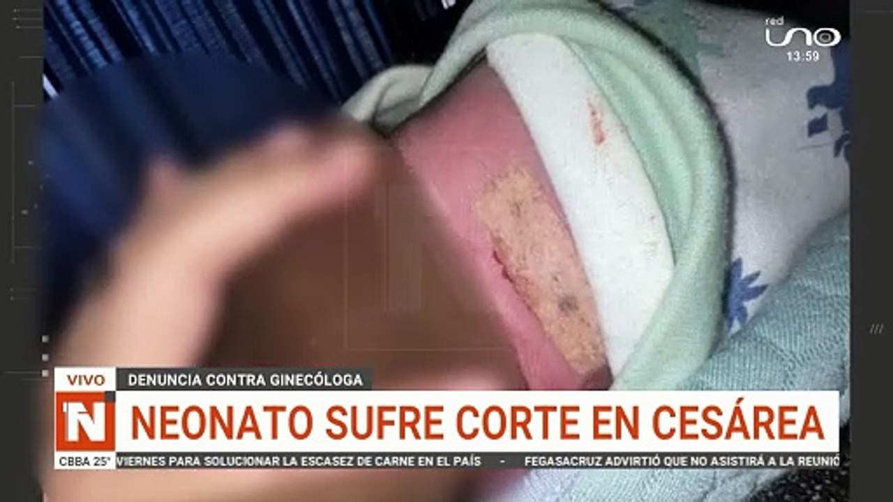 corte recien nacido