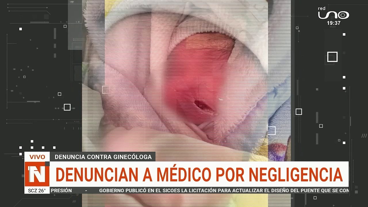 corte a bebe