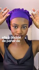 Atteinte d'alopécie depuis ses 14 ans, elle se rase la tête