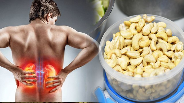 Cashew Side Effects In Hindi: 1 दिन में काजू कितना खाना चाहिए | Kaju Khane Ke Nuksan | Boldsky