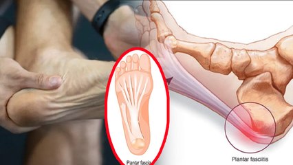 Plantar Fasciitis Symptoms & Causes in Hindi: प्लांटर फेशिआइटिस क्या है, लक्षण और कारण|Boldsky