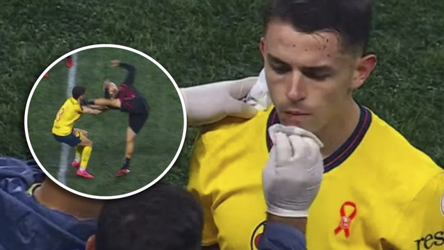 Álvaro Fidalgo confirma que Nico Díaz se disculpó con él tras el golpe en el Xolos vs. América