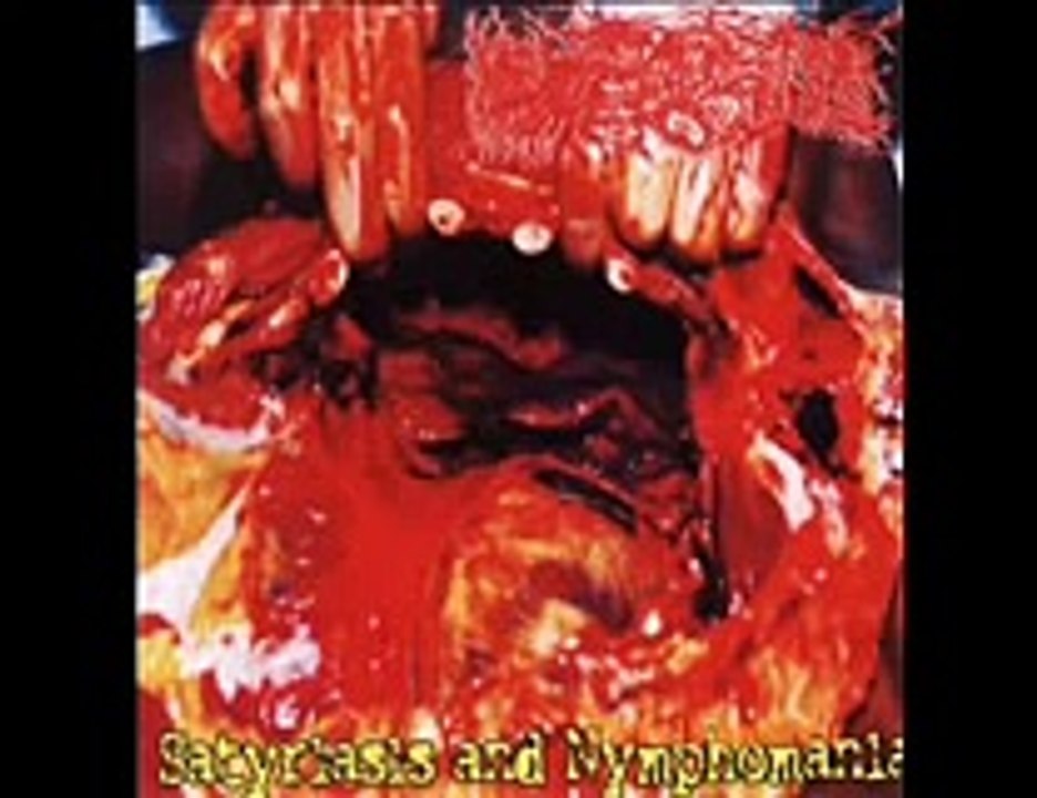 #MetalMexicano PARACOCCIDIOIDOMICOSISPROCTITISSARCOMUCOSIS - Satiryasis and Nymphomania (2002)