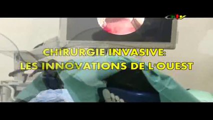chirurgie invasive du 22 Novembre 2024 crtv ouest