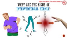 What are the signs of intervertebral hernia?