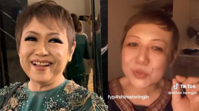 Pundi kencing lemah, Shima terpaksa pakai lampin… Aktif di TikTok cara jana pendapatan