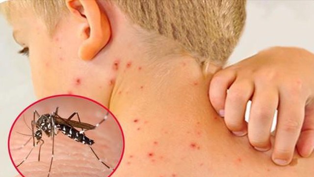 TPHCM ghi nhận ca tử vong đầu tiên trong năm 2024 do sốt xuất huyết | VTC Now