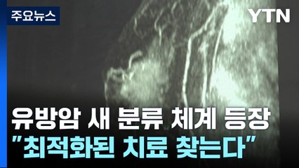 유방암 새 분류 체계 등장..."최적화된 치료 찾는다" / YTN