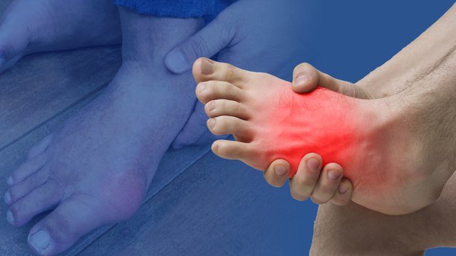 5 cách đào thải axit uric thần tốc khỏi cơ thể có thể bạn chưa biết