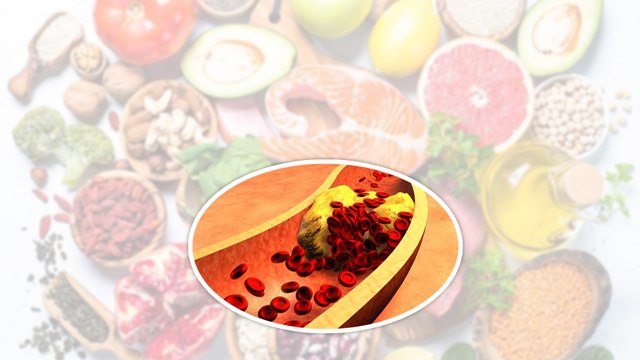 4 siêu thực phẩm giàu cholesterol nhưng người mỡ máu vẫn có thể ăn thoải mái