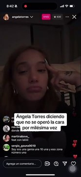 Ángela Torres rompió todos los mitos: se animó a contar qué operaciones se hizo en la cara y dejó a todos helados