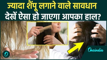Side Effects Of Using Shampoo: ज्यादा शैंपू लगाने से कैसा नुकसान, खुजली के अलावा और क्या होता है ?