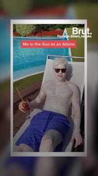 What people with albinism want you to know