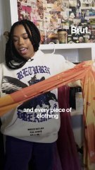 Creating art with vitiligo spots