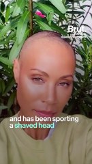 Understanding Alopecia: Autoimmune Hair Loss 🌿