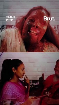 An Acid Attack Didn’t Scar Her Dreams