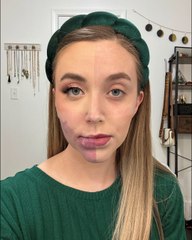 Woman born with facial birthmark slammed by trolls for choosing to lighten it