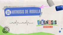 06 ARTROSIS DE RODILLA