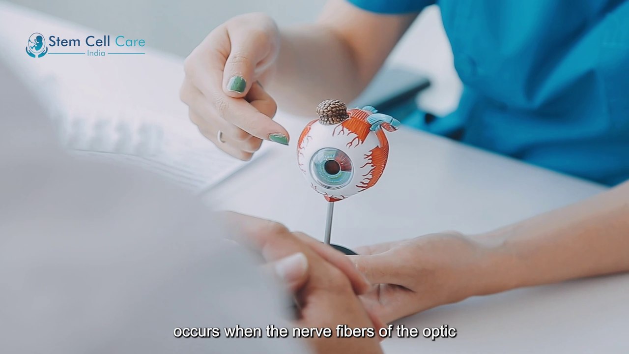 Exosome Treatment For Optic Nerve Atrophy | Stem Cells | Exosome |