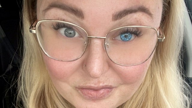 Mum fitted with glittery false eye after having it removed due to rare condition