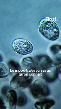 9 questions très simples sur le mpox