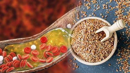 Alsi For High Cholesterol: हाई कोलेस्ट्रॉल में अलसी के फायदे, Benefits In Hindi|Boldsky