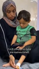 Born into unimaginable hardship—do these little hearts deserve this?