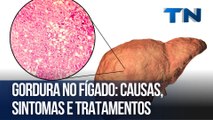 Gordura no fígado: causas, sintomas e tratamentos | Cuide-se Bem!